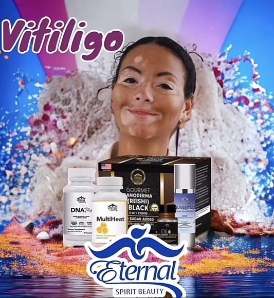 Kit Vitiligo